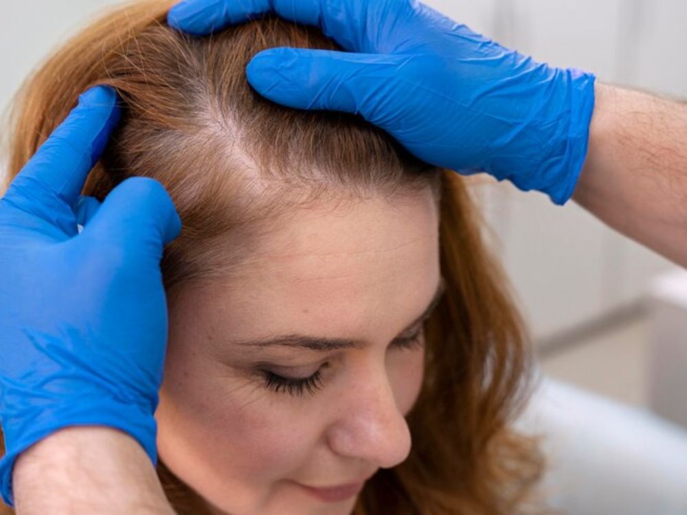 Doenças que podem causar queda de cabelo