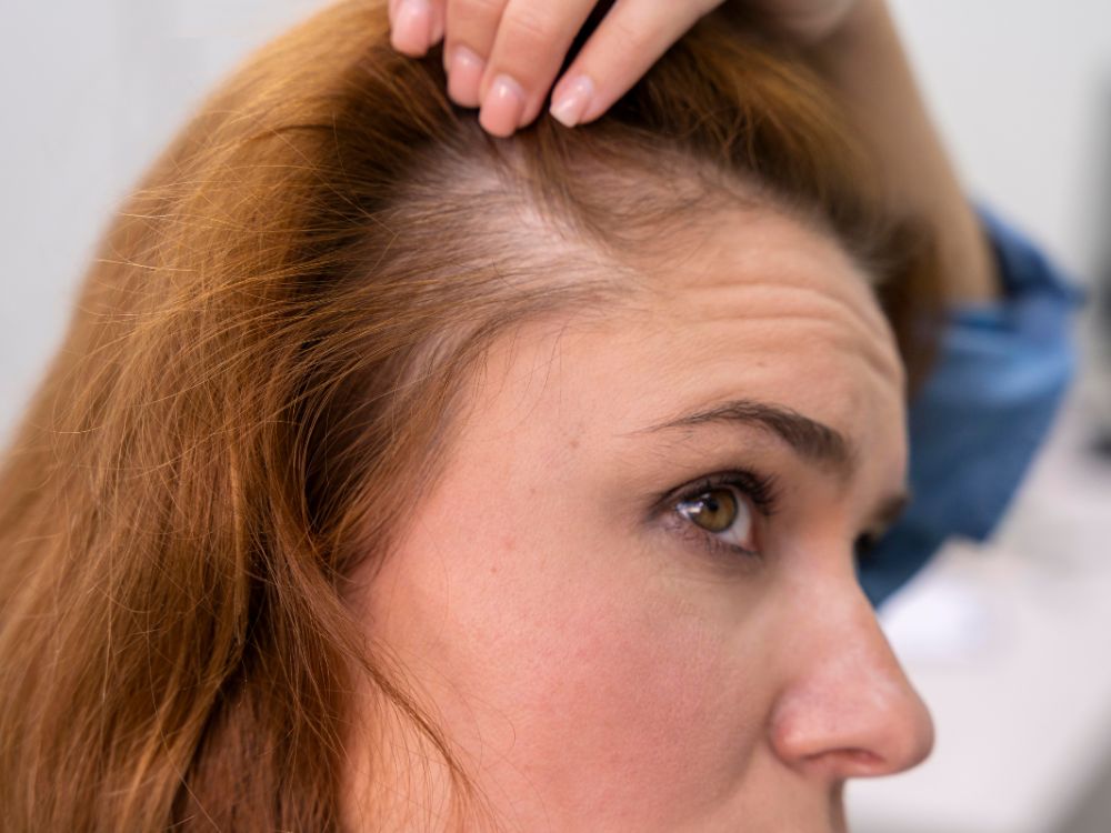 Como tratar queda de cabelo.